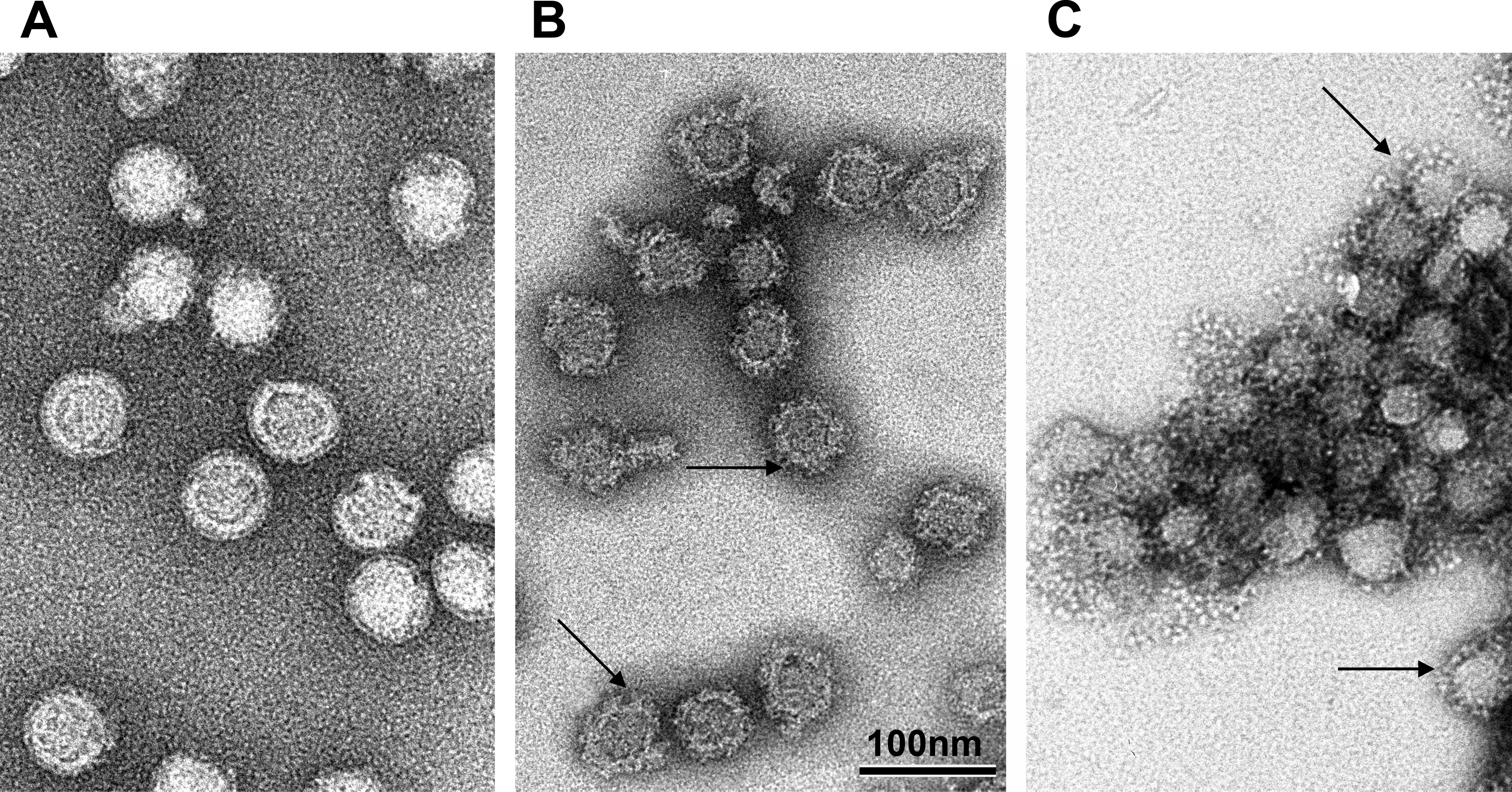What Is Bourbon Virus and Why Is Its First New York Case Alarming?